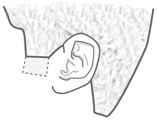 sideburns Illustration of side burn length going to mid-ear