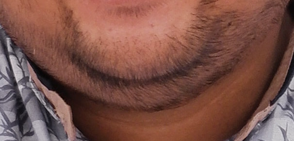 close up of beard stubble on double chin